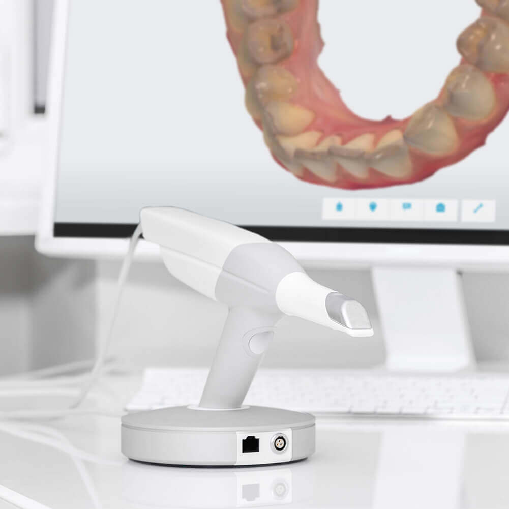itero scanner